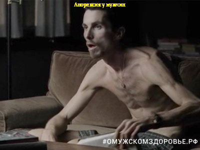 Анорексия у мужчин