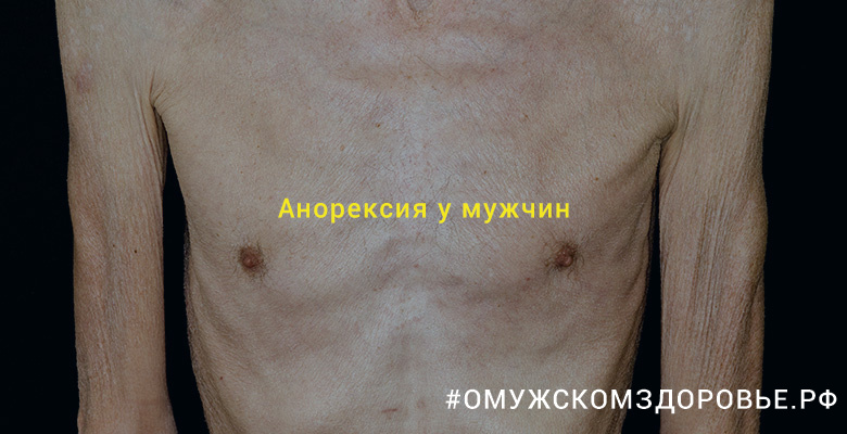 Анорексия у мужчин