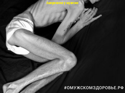 Анорексия у мужчин
